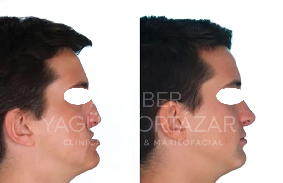 Cirugía maxilofacial Clínica dental y maxilofacial Aitziber Yagüe Cortázar Soria