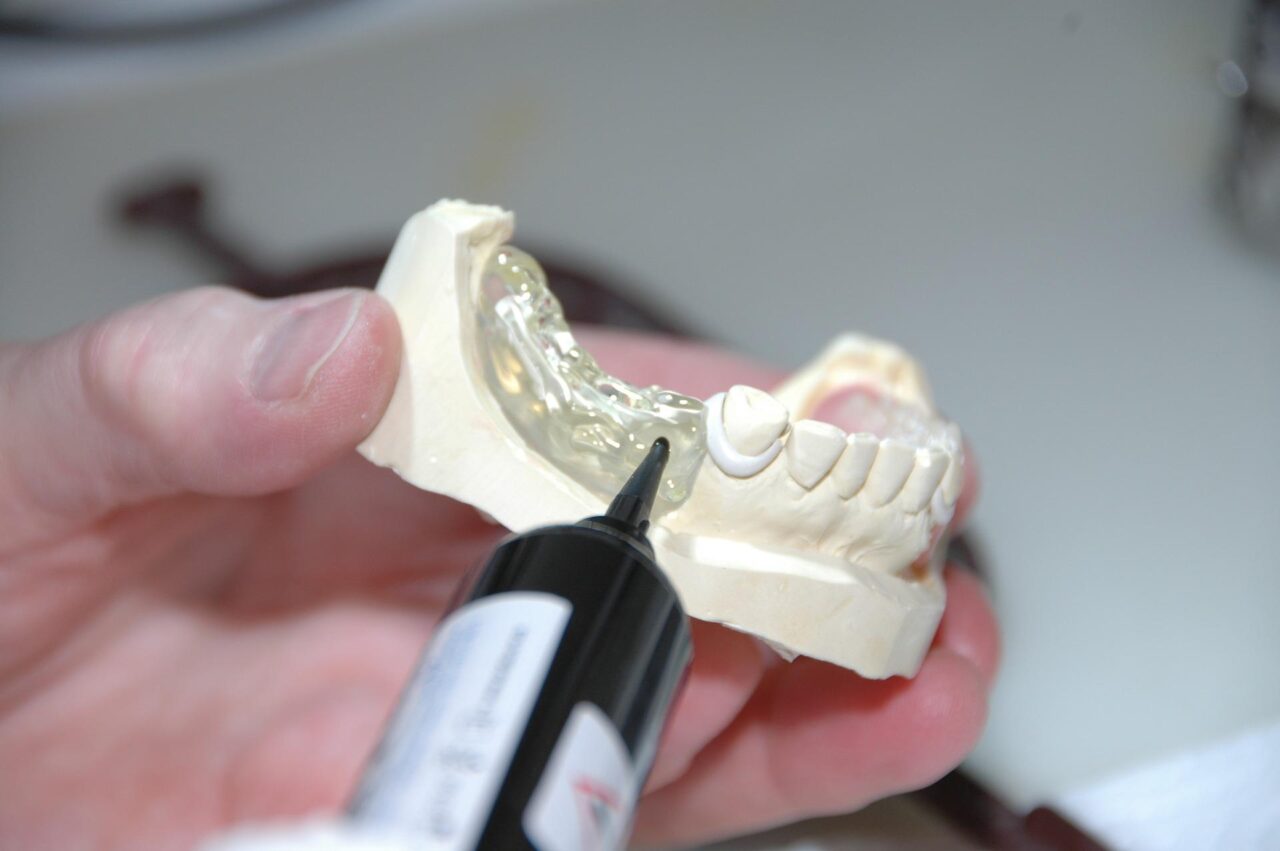 https://aitziberyaguecortazar.com/wp-content/uploads/2017/11/blog-tecnologia-dental-clinica-dental-maxilofacial-aitziber-yague-cortazar-soria-1280x851.jpg