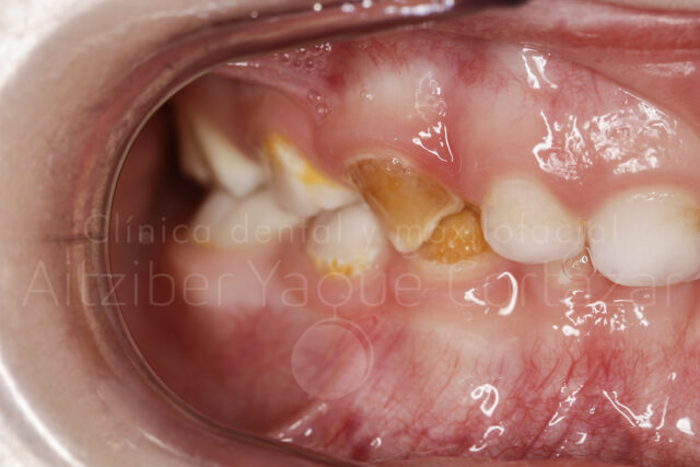 Odontopediatra 1 Clínica Dental Maxilofacial Aitziber Yagüe Cortázar
