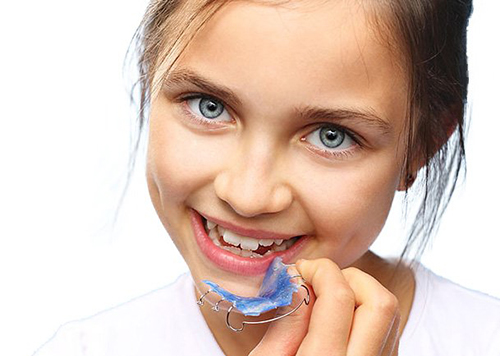 Ortodoncia interceptiva: Beneficios en niños