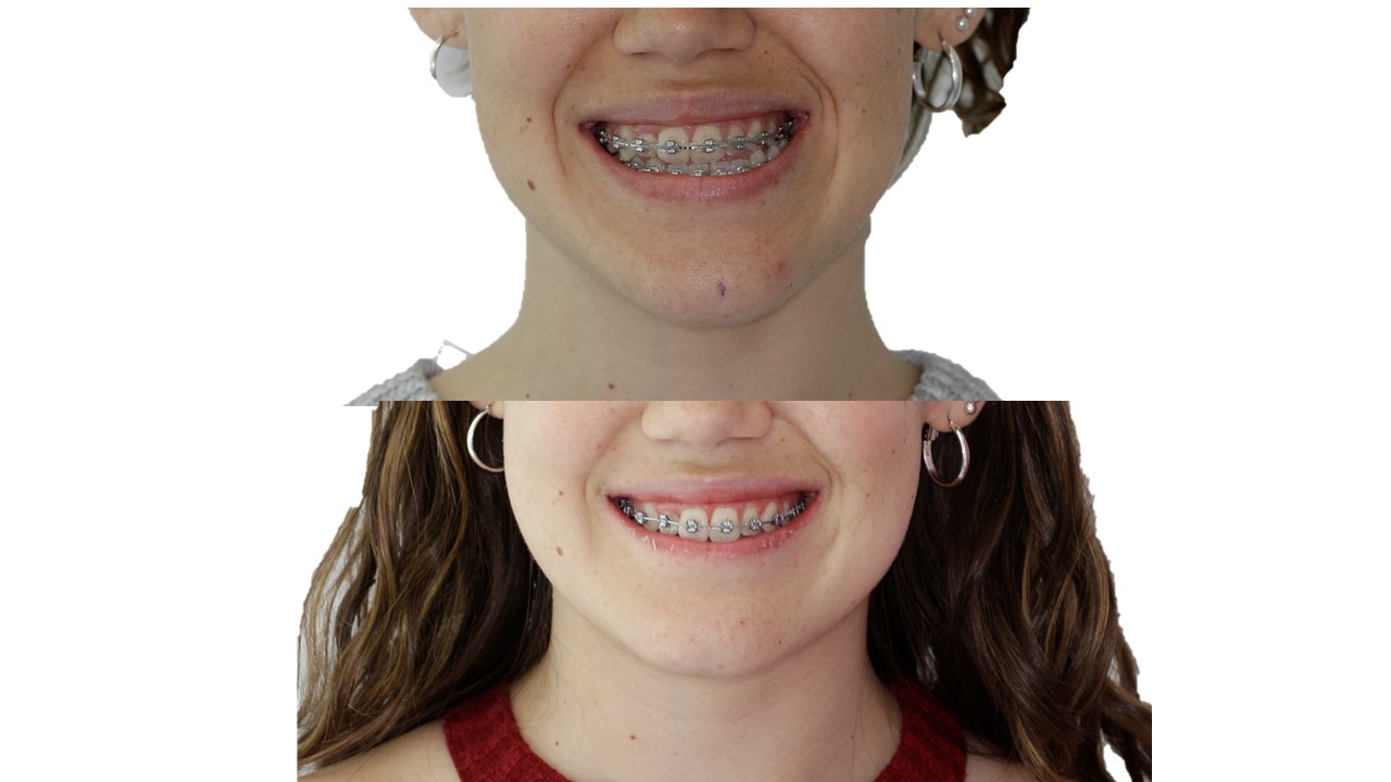 Ortodoncia Clínica Dental Maxilofacial Aitziber Yagüe Cortázar