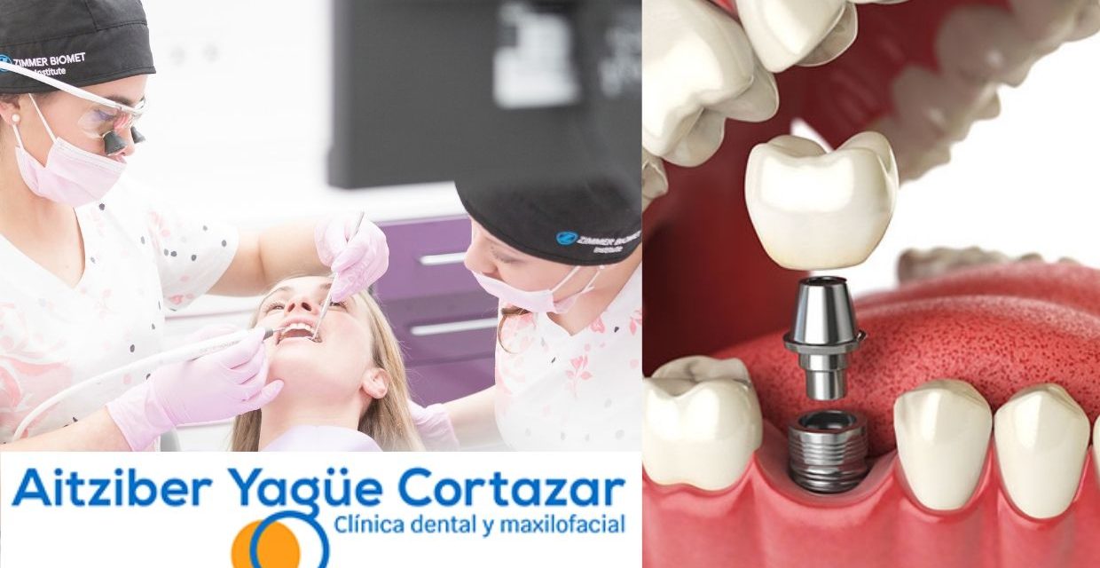 https://aitziberyaguecortazar.com/wp-content/uploads/2021/01/implantologia-dental-mitos-soria-odontologia-aitziber-1240x640.jpg