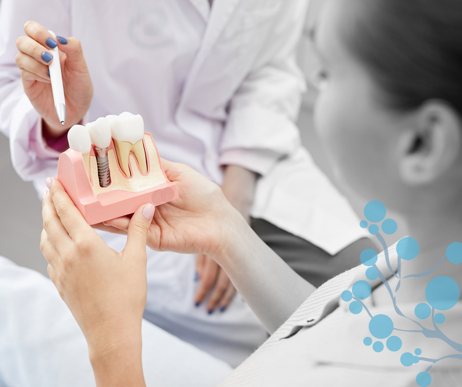 Servicios Implantes Dentales Aitziber Yagüe Clínica Dental Soria