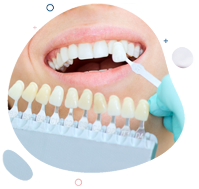 Estética Dental Clínica Dental Aitziber