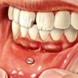 Fisuras Fracturas Dentales Piercing Boca Salud Bucodental Clínica Dental Maxilofacial Aitziber Yagüe Cortázar