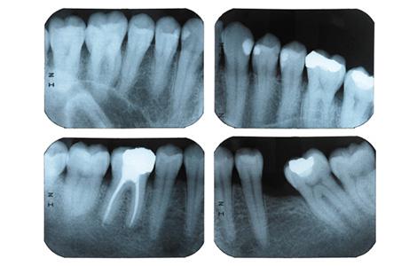 Los Rayos X en las clínicas dentales