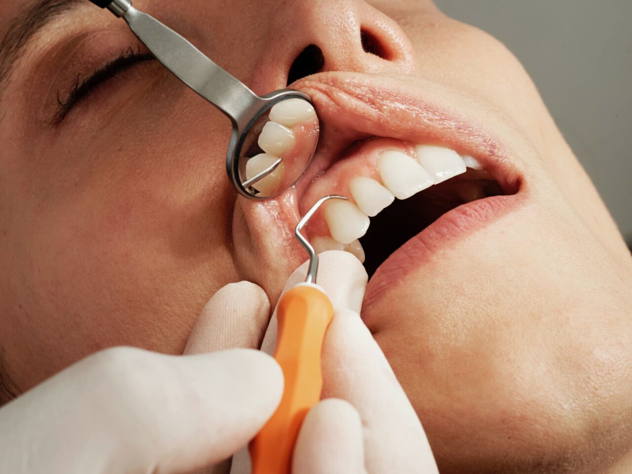 https://aitziberyaguecortazar.com/wp-content/uploads/2022/05/blog-encias-clinica-dental-maxilofacial-aitziber-yague-cortazar-soria-1280x960.jpg
