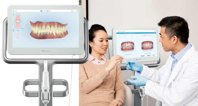 Escaner iTero Clínica Dental Maxilofacial Aitziber Yagüe Cortázar