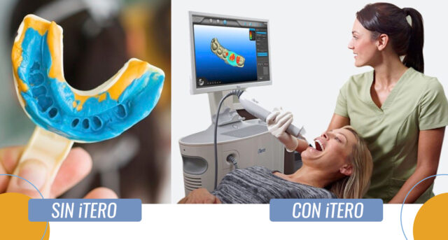 Tecnología Odontología iTero Clínica Dental Maxilofacial Aitziber Yagüe Cortázar