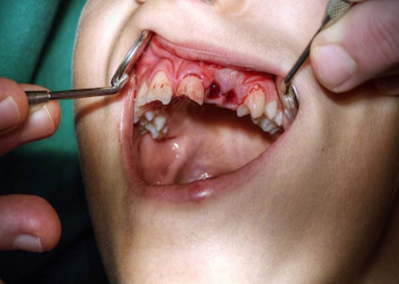https://aitziberyaguecortazar.com/wp-content/uploads/2022/05/blog-traumas-dentales-ninos-clinica-dental-maxilofacial-aitziber-yague-cortazar-soria-1280x910.jpg