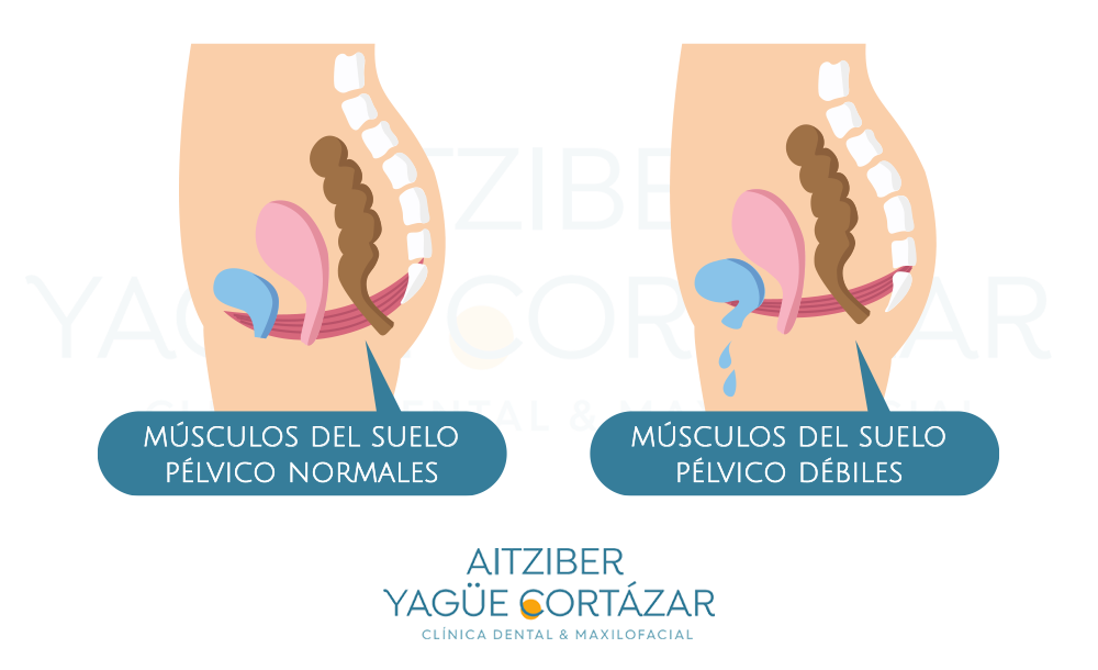 Cuidado suelo pélvico protocolo ginecológico Clínica dental, estética y maxilofacial Aitziber Yagüe Cortázar