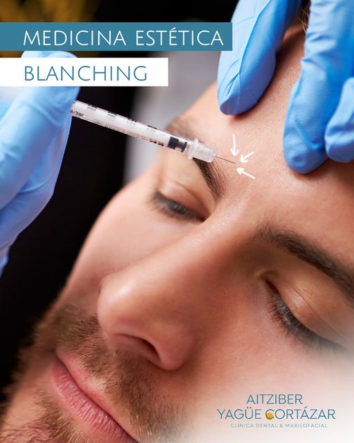¿En qué consiste el Blanching?