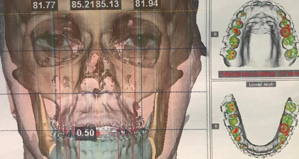 ¿Todos los tratamientos de ortodoncia son iguales?