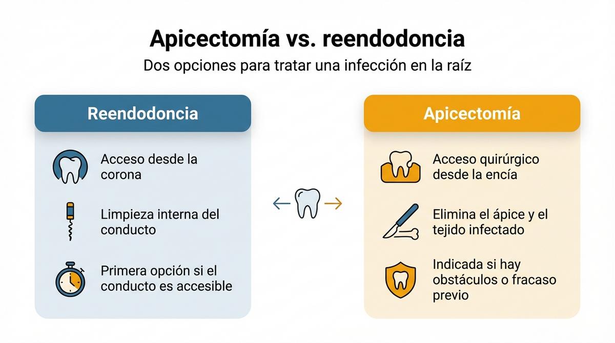 Diagrama comparativo entre reendodoncia y apicectomía para tratar infecciones en la raíz del diente.