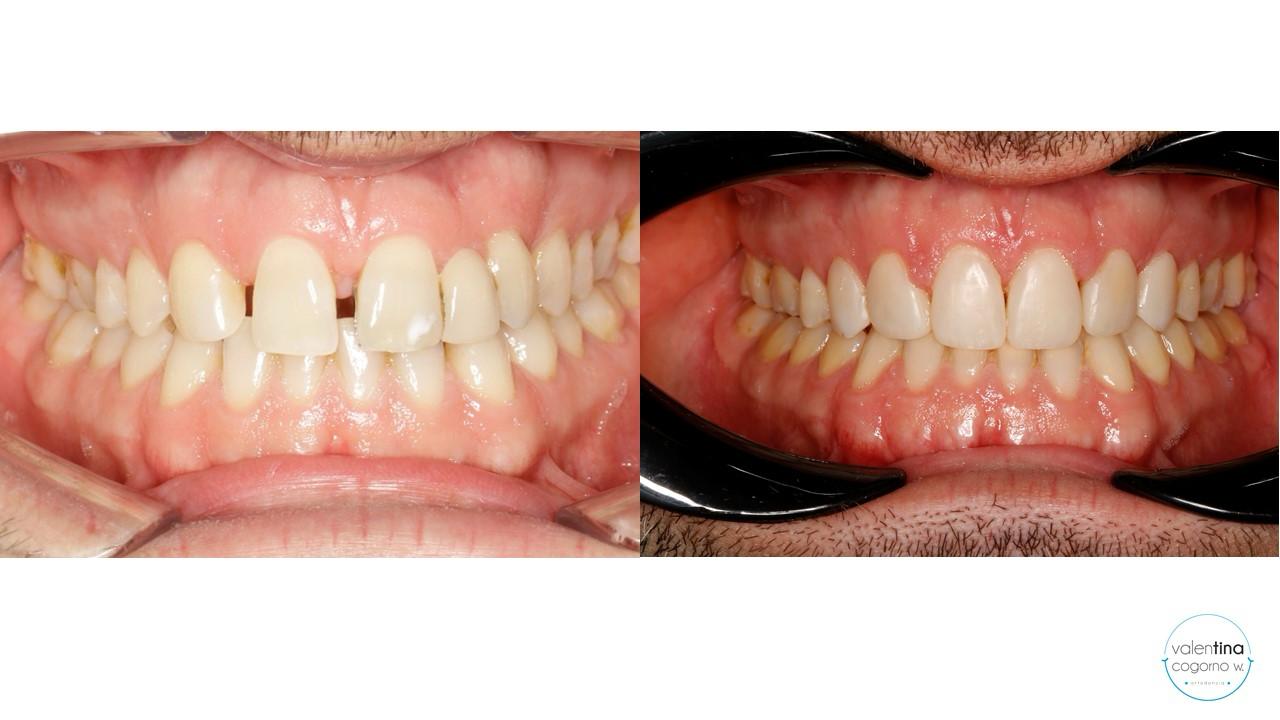 https://aitziberyaguecortazar.com/wp-content/uploads/2026/06/ortodoncia-tratamiento.jpg